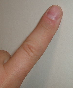 finger