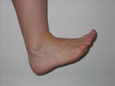 Foot