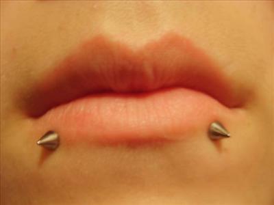 snake bites