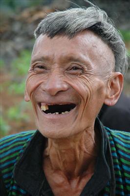 Xấu Trai