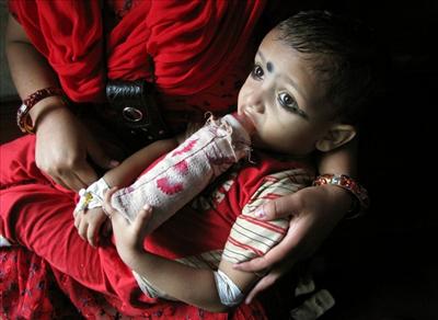 থ্যালাসেমিয়া  সম্পর্কে জানুন ?