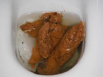 La cacca