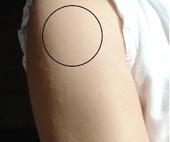 Upper arm